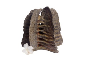 Indrani Singh Cassime, Expansion V